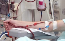 Bác sĩ BV Việt Đức cảnh báo: 3 triệu chứng "chỉ điểm" hai quả thận có thể đang bị hư hỏng