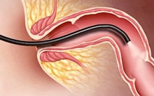 Bác sĩ khuyến cáo: Những dấu hiệu cảnh báo có thể là ung thư, nên chú ý đi khám sớm