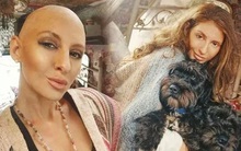 Đừng bỏ qua 7 triệu chứng cho thấy bạn có thể bị ung thư vú, không phải ai cũng may mắn thoát chết như cô gái này