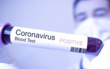 Bệnh nhân nhiễm Covid thứ 33 đã tham quan nhiều điểm du lịch đông người