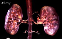 Sáng nào tỉnh giấc cũng thấy cơ thể "phản ứng kỳ lạ" thế này thì có thể thận của bạn đang gặp vấn đề nghiêm trọng cần đi khám ngay