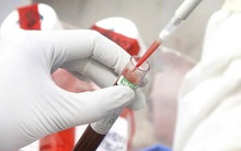 Lần đầu tiên các nhà khoa học lập được bản đồ miễn dịch của bệnh nhân Covid-19, rất nhiều bí ẩn sẽ được giải đáp