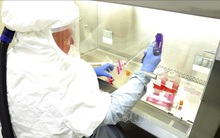 Hai người Mỹ gốc Việt đầu tiên tử vong vì virus SARS-CoV-2