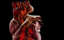 SARS-CoV-2 không chỉ tấn công phổi, còn là “kẻ thù nguy hiểm” của tim