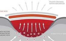 Đột phá: Các nhà khoa học phát minh ra loại gel có thể hàn gắn mọi vết thương trên cơ thể và trong cả nội tạng