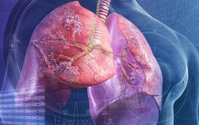 Nếu cơ thể có 2 chỗ lồi và 3 chỗ đen sạm: Bệnh phổi đang điểm danh bạn, hãy đi khám