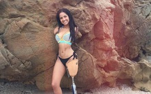 Mất 3 chi khi mới lên 5 tuổi, cô gái không đầu hàng số phận mà trở thành người truyền cảm hứng về nghị lực sống phi thường