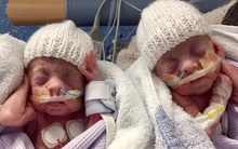 Cặp anh em sinh đôi sinh non từng chỉ 'nhỏ như chuột' nhưng vẫn sống sót khiến các bác sĩ phải ngỡ ngàng giờ ra sao?