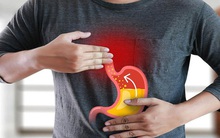 Trào ngược dạ dày: Bệnh của “thời đại mới”, tác nhân lớn nhất gây ung thư dạ dày và 7 điều buộc phải làm để không rơi vào cảnh bệnh tình