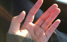 Bàn tay của những người hay đau ốm, dễ mắc bệnh thường "lên tiếng" cảnh báo qua 5 dấu hiệu này: Ai cũng từng mắc nhưng lại bỏ qua