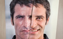 Hội chứng trầm cảm cười: Khi đằng sau nụ cười hạnh phúc là những nỗi đau không ai thấu