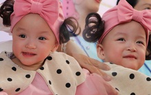 Gần 3 tháng sau ca phẫu thuật tách rời, cặp song sinh Trúc Nhi - Diệu Nhi được xuất viện, xuất hiện cực rạng rỡ và dễ thương