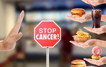 Nhiều người thường xuyên ăn uống theo 3 kiểu tiện lợi này mà không biết đang tự "nuôi dưỡng" mầm bệnh ung thư