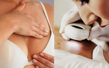 Trang web y tế hàng đầu của Mỹ cảnh báo 15 dấu hiệu ung thư: Đi khám ngay dù chỉ gặp dấu hiệu nhỏ!