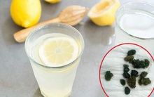 Xổ ra cả đống sỏi gan, sỏi mật nhờ uống dầu ôliu, dầu dừa: Sự thật kinh hoàng phía sau mới là điều bạn cần biết về trào lưu detox đang "làm mưa gió" trên MXH