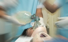 Một phụ nữ bị nhồi máu não và tử vong sau nửa tháng, bác sĩ thở dài: Ăn loại gia vị này hàng ngày thì làm sao mạch máu không bị tắc