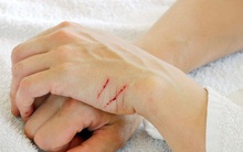 7 thói quen nhiều người làm tưởng chừng rất bình thường nhưng lại là "thủ phạm" âm thầm gây hại sức khỏe