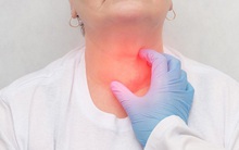 4 cách hiệu quả nhất để vượt qua bệnh tuyến giáp: Công việc, dinh dưỡng rất quan trọng