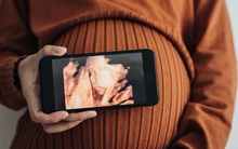 Sự thật đau đớn phía sau "thần dược" chuyển đổi giới tính thai nhi: Từ khát vọng lệch lạc đến "độc dược" tạo nên bao đứa trẻ dị tật