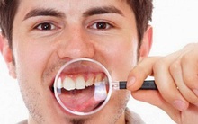 Nha sĩ Mỹ: 2 căn bệnh phổ biến do đeo khẩu trang trong thời gian dài, cần sớm khắc phục