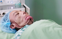 10 tiếng căng não phẫu thuật tìm lại cuộc đời cho người đàn ông "mặt quỷ", 15 năm ngủ ngồi