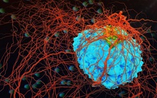 Không phải cứ mắc ung thư là chết: 4 loại ung thư có cơ hội được chữa khỏi trên 90% nếu như bạn ghi nhớ nguyên tắc này của bác sĩ