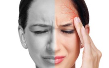 Chứng đau nửa đầu tấn công cả người trẻ: 5 cách xử lý nên ghi nhớ để dùng khi cần