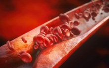 “3 bẩn” là dấu hiệu rõ nét nhất của những người hay ốm đau và tuổi thọ kém: Nếu có dù chỉ 1 cũng phải chấn chỉnh ngay