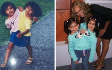 Bị chẩn đoán chỉ sống không quá 3 ngày, cặp song sinh từ chối phẫu thuật tách rời và cuộc sống 18 năm sau khiến ai cũng ngưỡng mộ