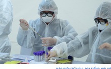 Giá xét nghiệm Covid 19 được tính như thế nào?