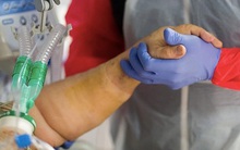 Chuyên gia cảnh báo: Người thừa cân, béo phì có nguy cơ tử vong cao hơn khi mắc Covid-19