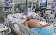 Bé trai 13 tuổi biến chứng suy đa cơ quan nặng vì sốt xuất huyết: Bác sĩ cảnh báo căn bệnh nguy hiểm