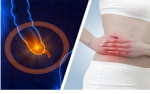 Bệnh lý viêm ruột thừa sợ nhất hai từ “quá muộn”: Bác sĩ BV Việt Đức lưu ý những phản xạ cần có khi đau bụng để bảo toàn tính mạng