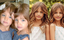 Cặp song sinh được mệnh danh đẹp nhất thế giới, 6 tháng tuổi đã nhận hợp đồng quảng cáo có ngoại hình thay đổi ra sao sau 10 năm?