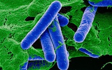 Bộ Y tế cấp phép nhập khẩu thuốc giải độc ngộ độc thực phẩm hiếm gặp