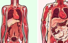 Mỡ bụng không chỉ làm bạn xấu đi, 5 mối nguy hiểm này còn khiến sức khỏe tồi tệ hơn