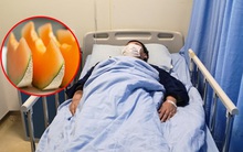 Ăn dưa lưới để qua đêm trong tủ lạnh, một người bị sốc, suy thận nghiêm trọng và viêm dạ dày ruột cấp tính