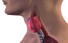 17 tuổi đã bị lùn đi 6cm trong vòng 4 năm: Căn bệnh gây loãng xương cha mẹ nên biết