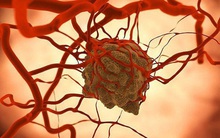 4 nhóm thực phẩm gây ung thư "đầu bảng" được nhiều tổ chức lên tiếng cảnh báo: Món số 1 là thứ khoái khẩu của giới trẻ, nhiều người biết hại nhưng không thể từ bỏ