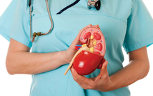 Người đàn ông 36 tuổi bị sỏi thận tái đi tái lại nhiều lần: Bác sĩ BV Việt Đức cảnh báo lối sống chính là "chủ mưu"