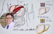 Bác sĩ Việt tại Mỹ chỉ ra "thủ phạm" gây bệnh gan nhiễm mỡ dù không uống rượu bia, cách ngăn ngừa tốt nhất là điều chỉnh một điều này
