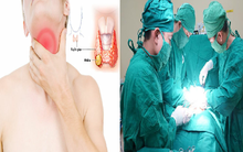 Ung thư tuyến giáp chiếm 90% bệnh nhân ung thư nội tiết, dấu hiệu âm thầm nhưng có thể điều trị được: Bác sĩ BV Bạch Mai chỉ rõ 5 điều quan trọng về căn bệnh này