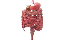 Đường ruột là gốc của bệnh tật: Hãy làm 5 điều sau để dọn sạch cặn bã trong đường ruột