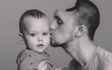 Ông bố trẻ đột ngột phải cắt bỏ nửa bộ não, lý do bắt nguồn từ một sai lầm đơn giản nhiều người mắc phải