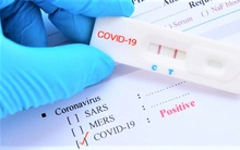 Bộ Y tế đề nghị doanh nghiệp báo cáo giá bán test xét nghiệm COVID-19