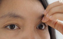 Không phải điềm lành hay gở, mắt chớp liên tục, mí mắt giật giật là dấu hiệu cảnh báo 6 nguy cơ sức khỏe