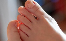 Nam giới có thận khỏe thường có 3 biểu hiện đặc trưng ở bàn chân, mong rằng bạn hội tụ tất cả