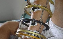 Thanh niên hối hận vì tốn 600 triệu cắt xương kéo dài chân và hệ lụy của vấn nạn phân biệt chiều cao ở giới trẻ Trung Quốc