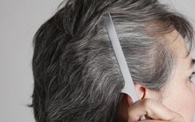 Bác sĩ gan mật cảnh báo: Tóc bạc xuất hiện ở vị trí này thì cần phải đi khám càng sớm càng tốt, có thể là dấu hiệu của tổn thương gan!