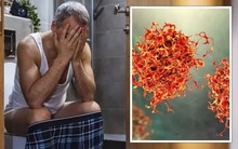 45 tuổi mắc ung thư trực tràng và lời CẢNH TỈNH cho ai tham công tiếc việc: Nhận thấy 4 triệu chứng ở tuổi trung niên, đi khám ngay vì ung thư đang đến